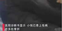 夜上海论坛：广西13岁女孩被迫卖淫染性病? 亲属质疑